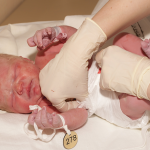 Obstetric Emergencies (OBS) - Narrogin