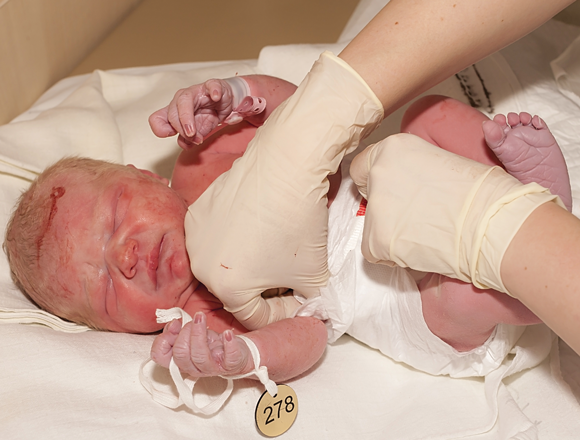 Obstetric Emergencies (OBS) - Narrogin